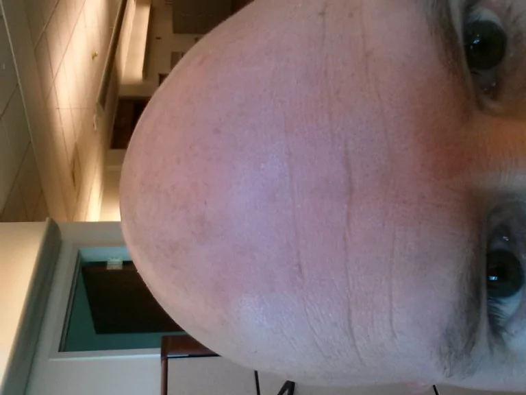 me1.webp