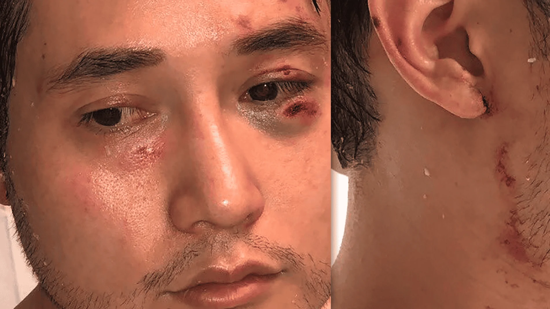 andy-ngo-brutalized.webp