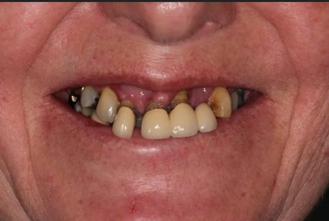 Teeth.webp